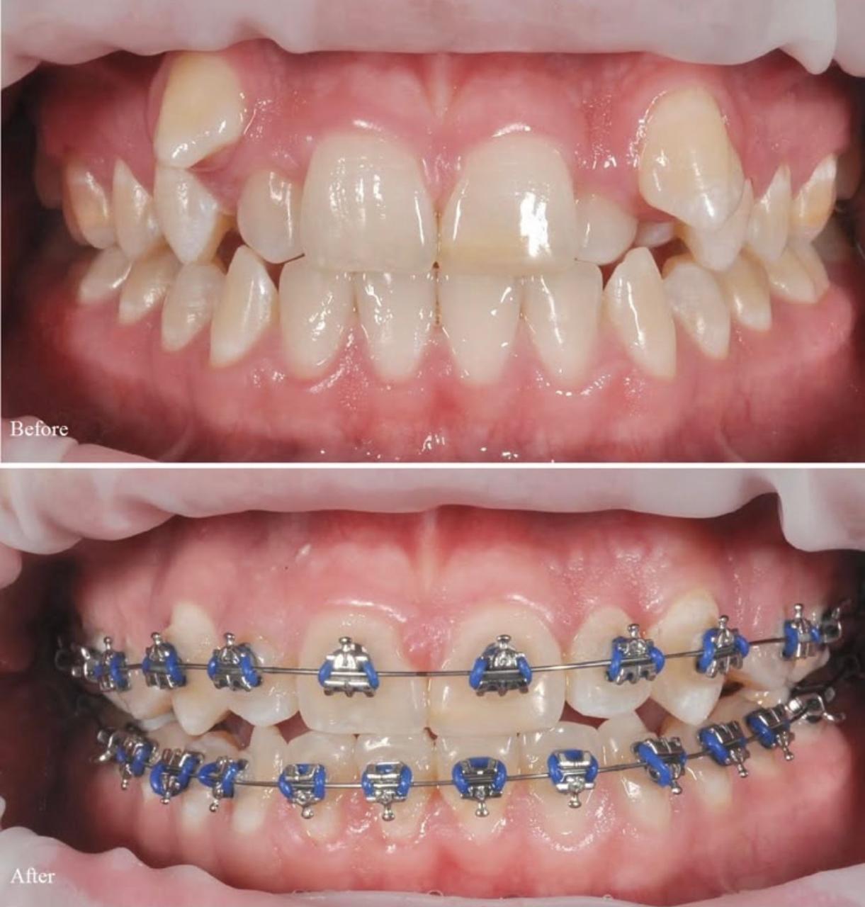 Orthodontics​